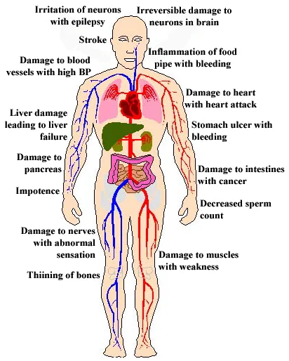 Alcoholism